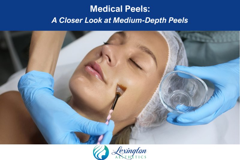Medical Peels A Closer Look at Medium-Depth Peels