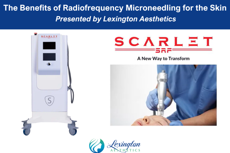 The Benefits of Radiofrequency Microneedling for the Skin