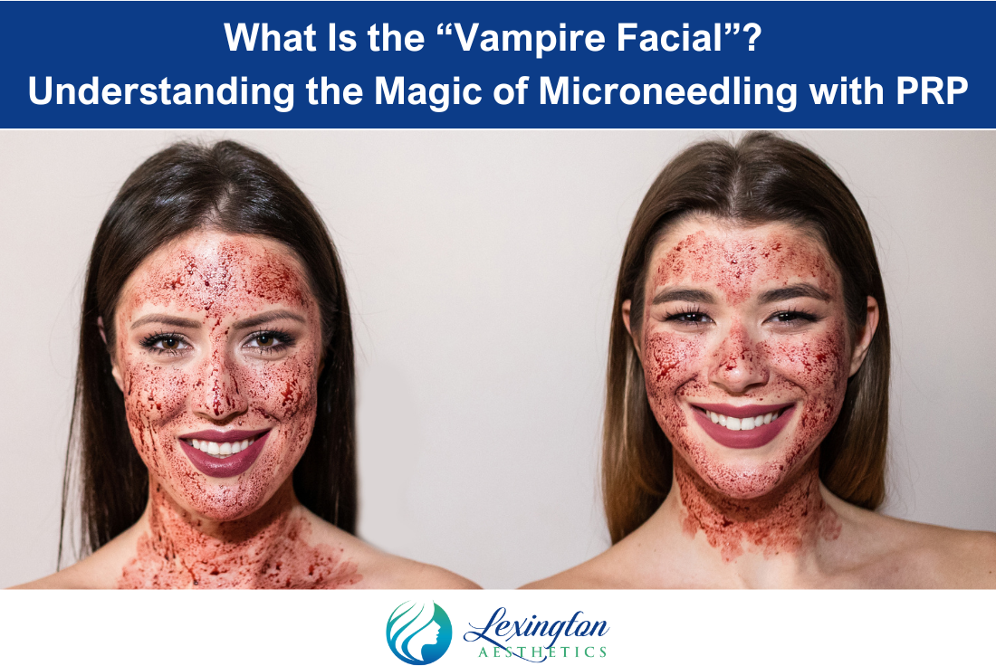 What Is the “Vampire Facial” Understanding the Magic of Microneedling with PRP